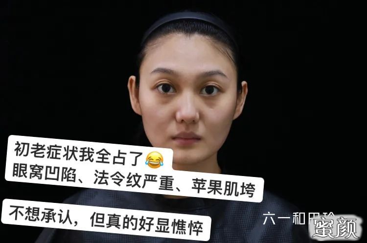 https://img.yiyiaimei.com/mnt/timg/200813/1311164c4-1.jpg 案例图片