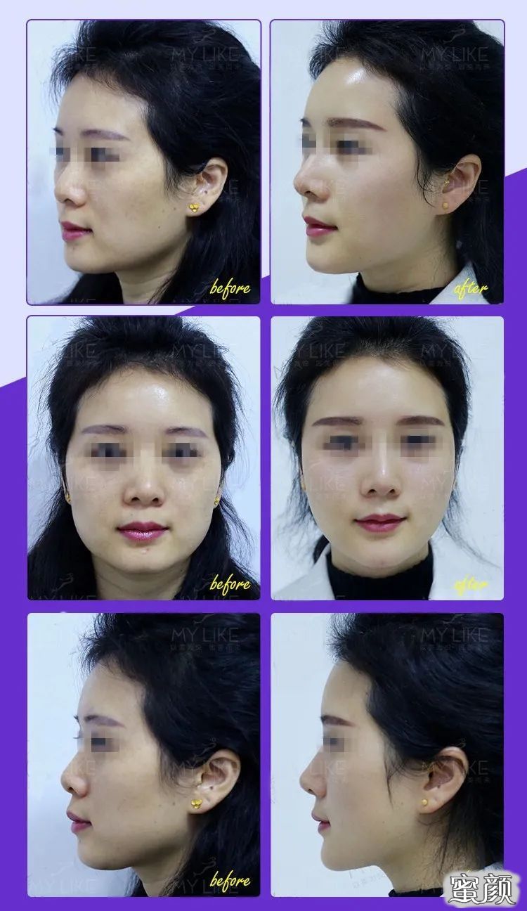 https://img.yiyiaimei.com/mnt/timg/200813/1313234013-6.jpg 案例图片