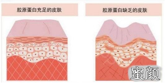 案例图片