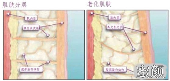 案例图片