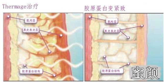 案例图片
