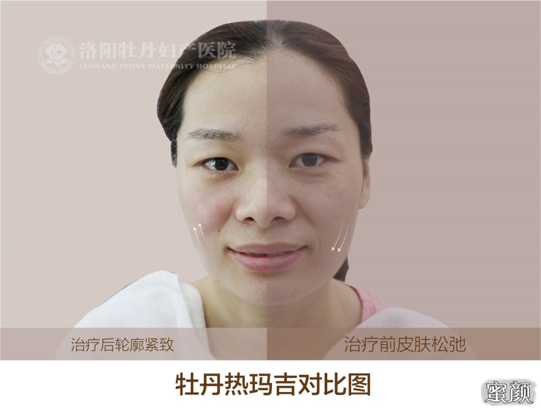 https://img.yiyiaimei.com/mnt/timg/200813/13215WI3-0.jpg