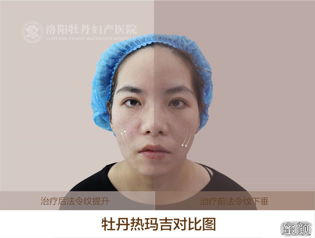 https://img.yiyiaimei.com/mnt/timg/200813/13220124Q-1.jpg