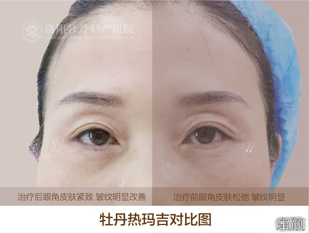 https://img.yiyiaimei.com/mnt/timg/200813/1322102113-2.jpg
