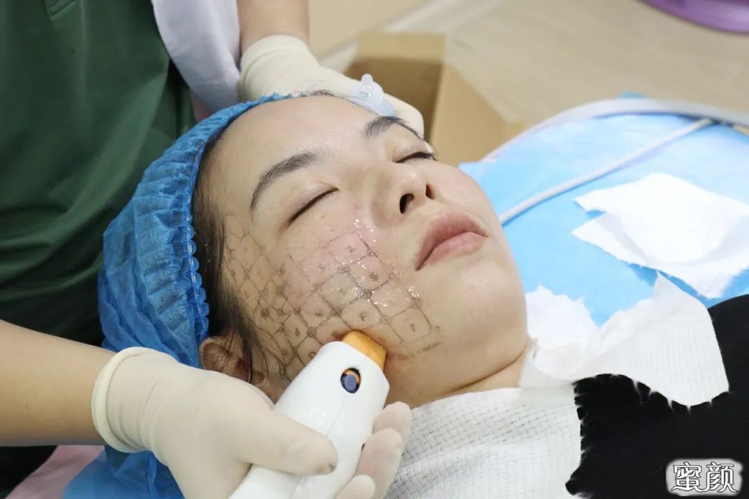 https://img.yiyiaimei.com/mnt/timg/200813/13224U1W-5.jpg