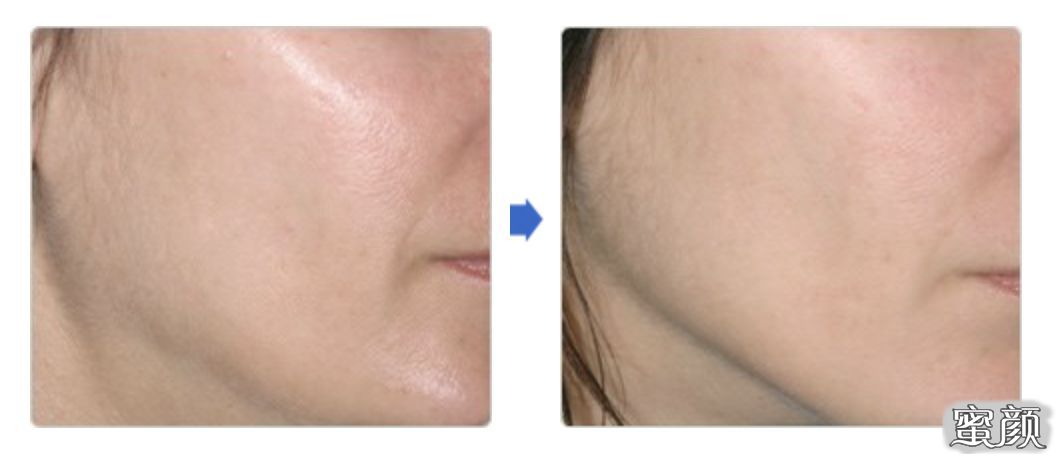 https://img.yiyiaimei.com/mnt/timg/200814/11504aC7-2.jpg 案例图片