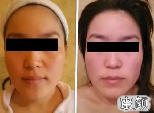 案例图片