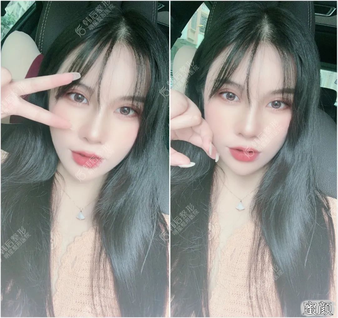 案例图片