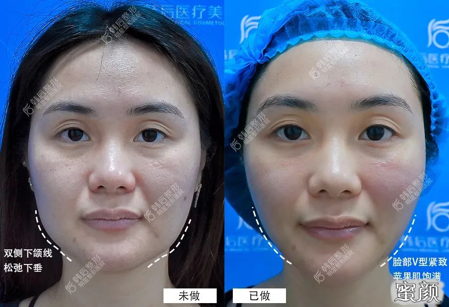 案例图片
