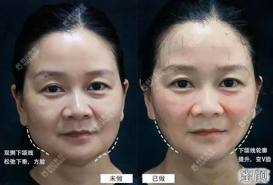 案例图片