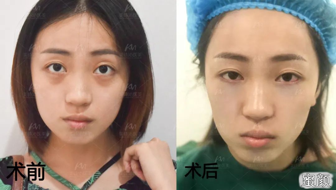 案例图片