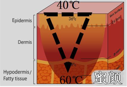 https://img.yiyiaimei.com/mnt/timg/200815/123H0OH-4.jpg 案例图片