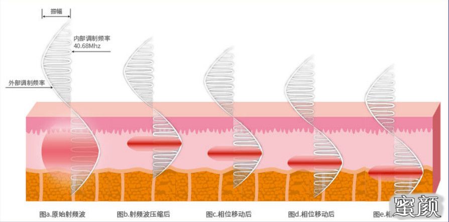 https://img.yiyiaimei.com/mnt/timg/200815/123H343Q-5.jpg 案例图片