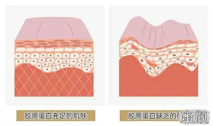 https://img.yiyiaimei.com/mnt/timg/200816/11315223Q-2.jpg 案例图片