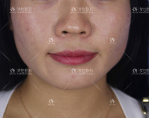 https://img.yiyiaimei.com/mnt/timg/200816/11334150c-1.jpg 案例图片