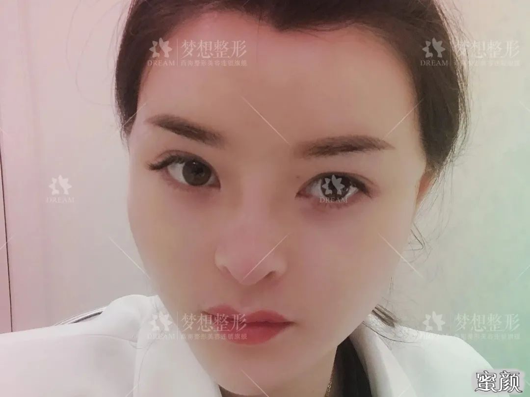 https://img.yiyiaimei.com/mnt/timg/200816/1134005959-4.jpg 案例图片