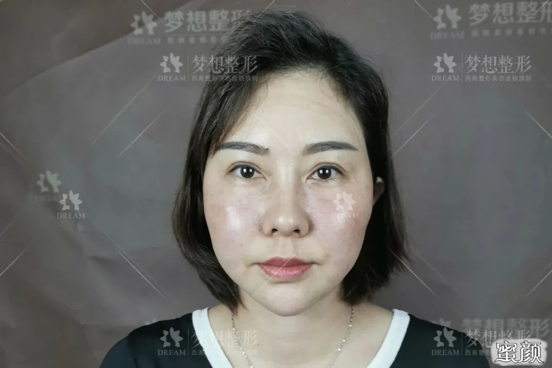 https://img.yiyiaimei.com/mnt/timg/200816/1134033Y1-5.jpg 案例图片