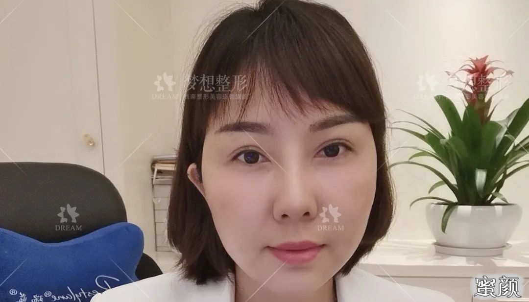 https://img.yiyiaimei.com/mnt/timg/200816/1134051045-6.jpg 案例图片