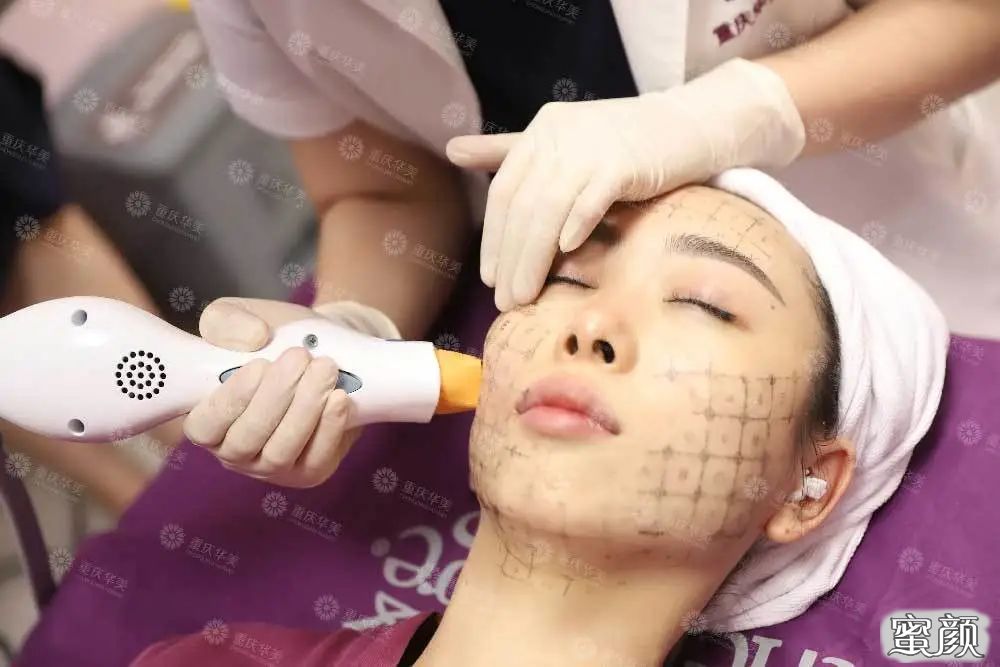 案例图片