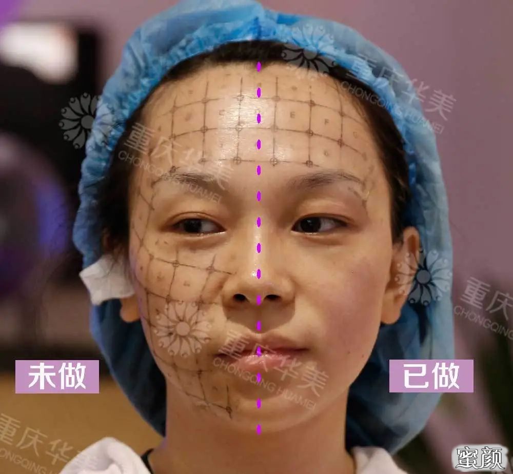 案例图片
