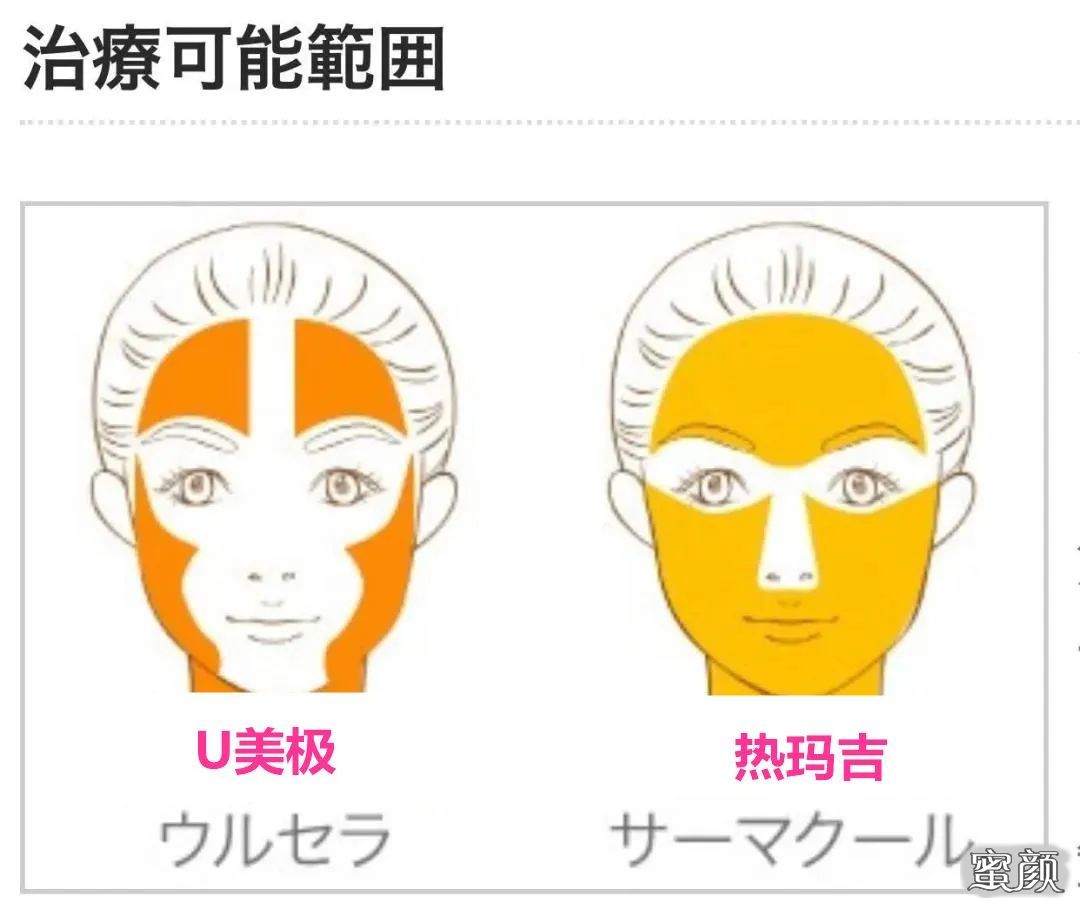 https://img.yiyiaimei.com/mnt/timg/200820/13230922Q-6.jpg 案例图片