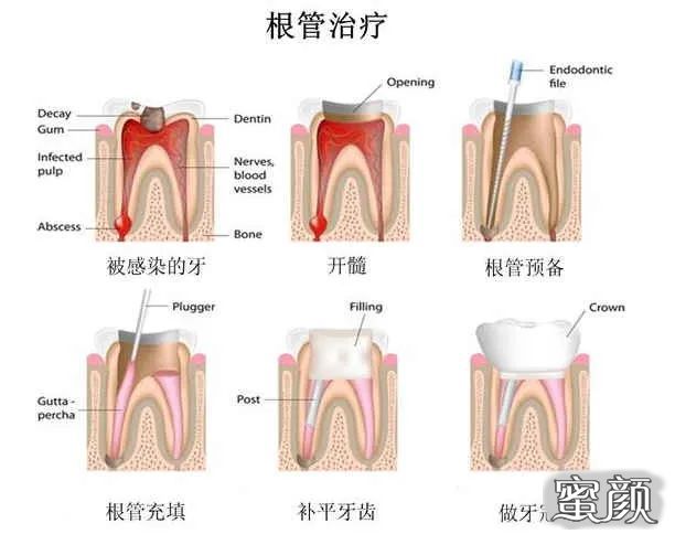 案例图片