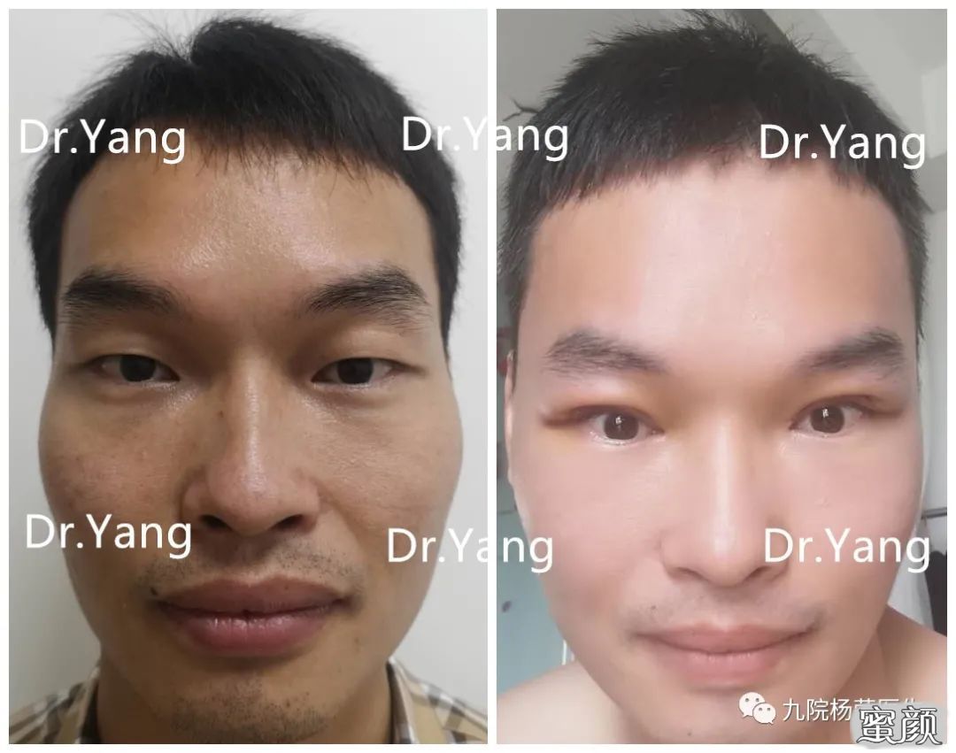 案例图片