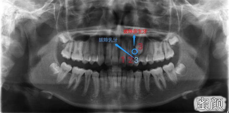 案例图片