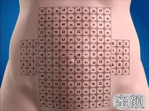 案例图片