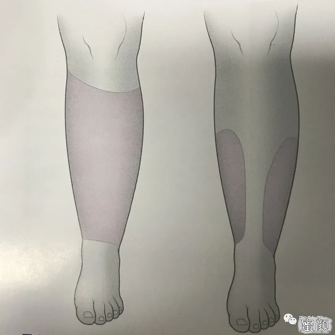 https://img.yiyiaimei.com/mnt/timg/200821/121J1C92-0.jpg 案例图片