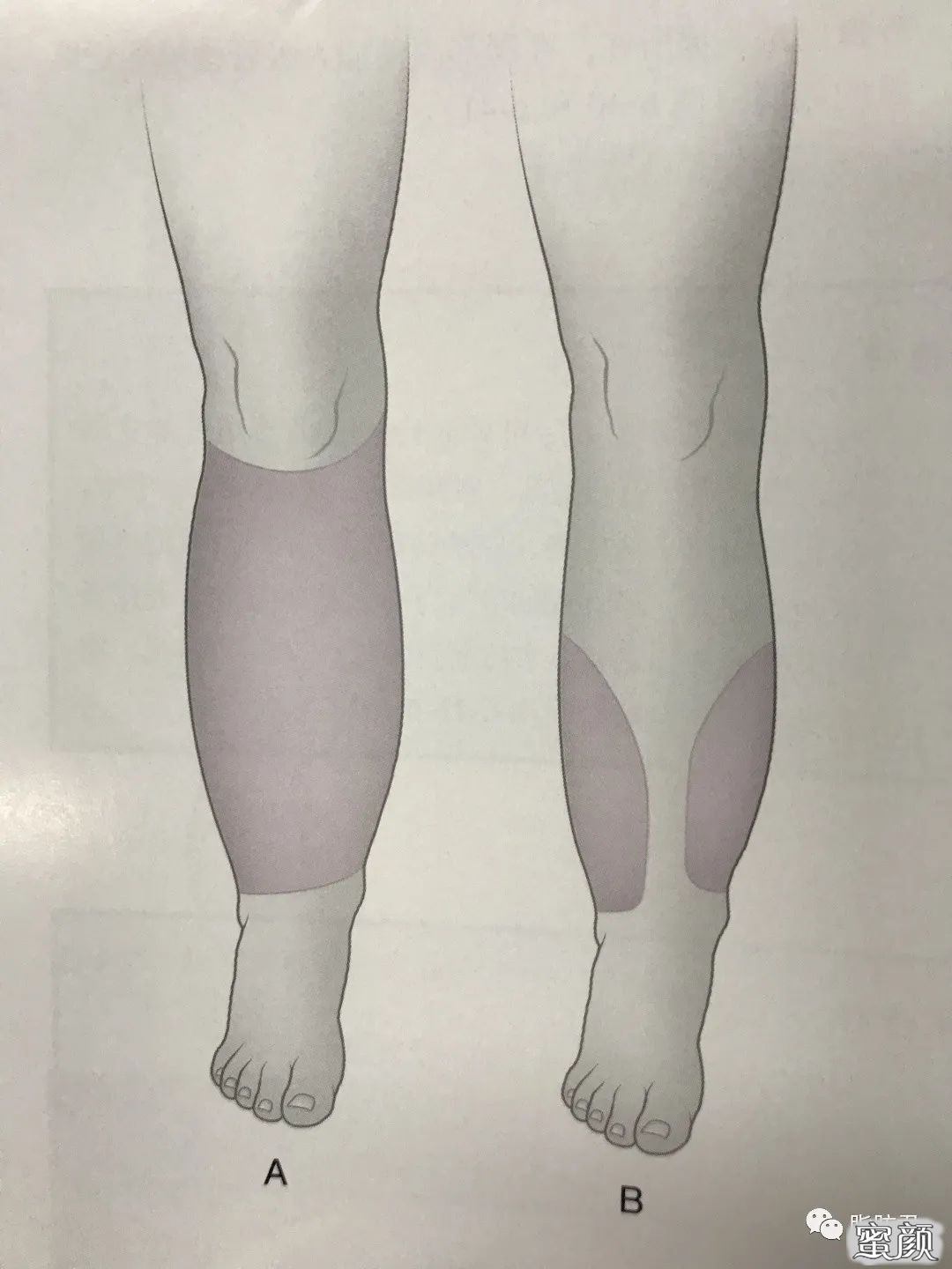 https://img.yiyiaimei.com/mnt/timg/200821/121J55V7-2.jpg 案例图片