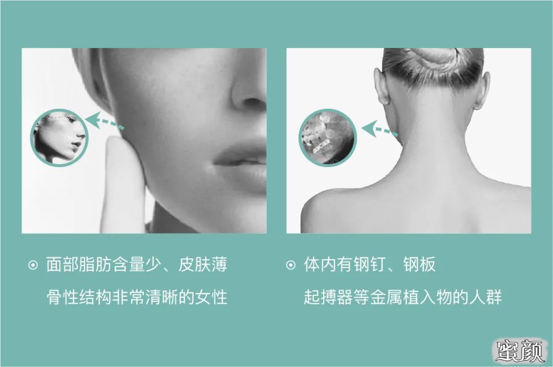 https://img.yiyiaimei.com/mnt/timg/200821/12291430T-0.jpg 案例图片
