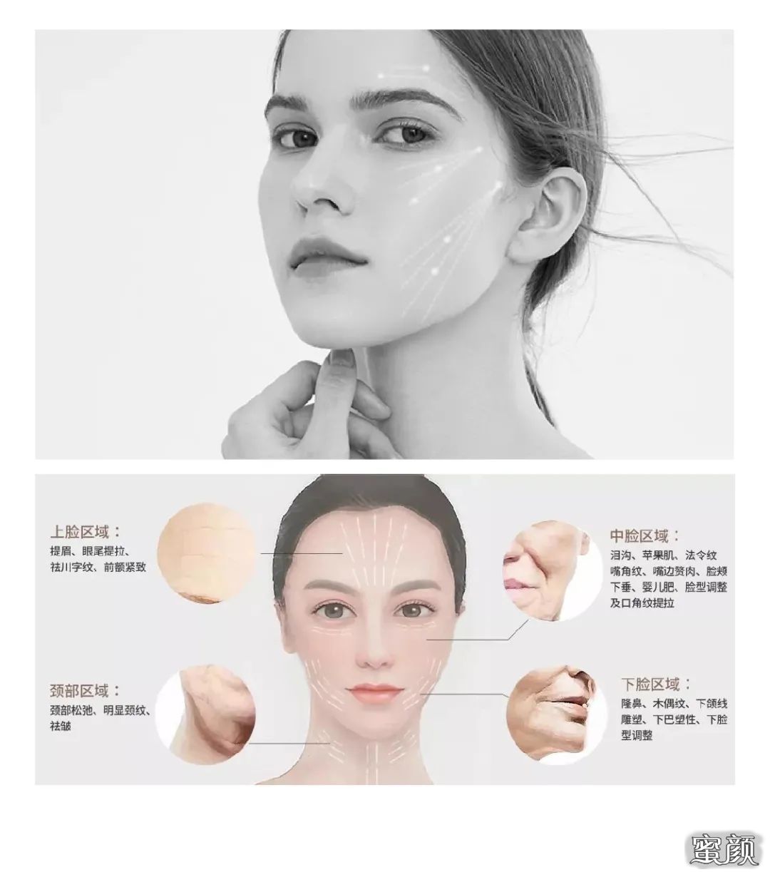 https://img.yiyiaimei.com/mnt/timg/200821/12294053U-5.jpg 案例图片