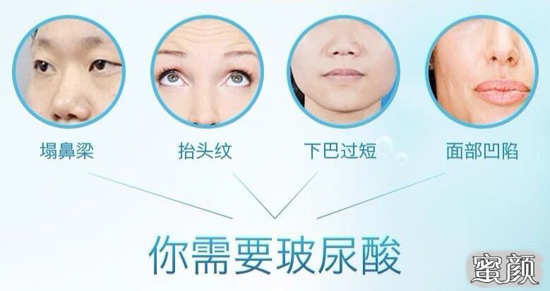 https://img.yiyiaimei.com/mnt/timg/200821/1251002123-2.jpg