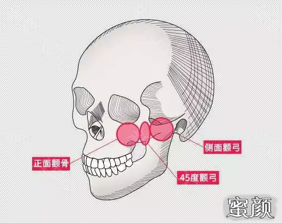 案例图片