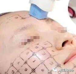 案例图片