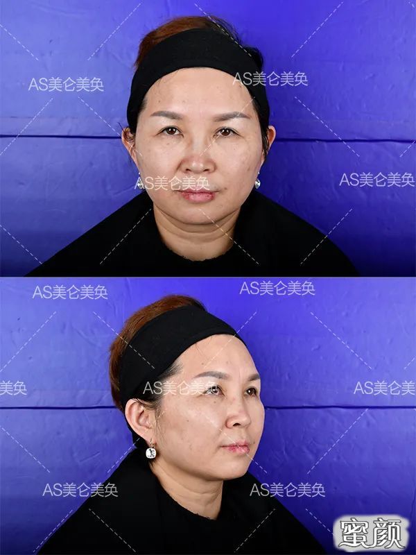 案例图片