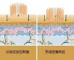 https://img.yiyiaimei.com/mnt/timg/200822/1456392125-6.jpg 案例图片