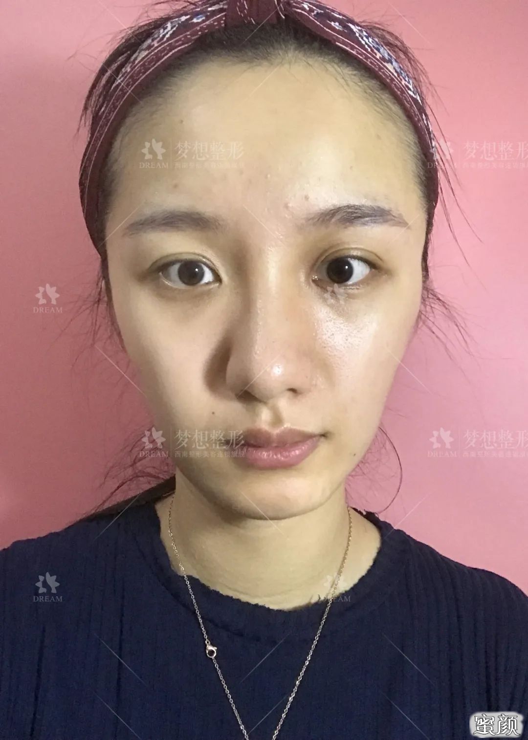 案例图片