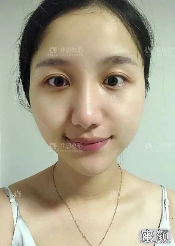 案例图片