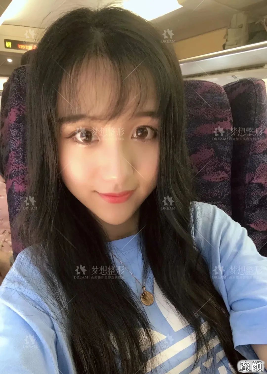 案例图片