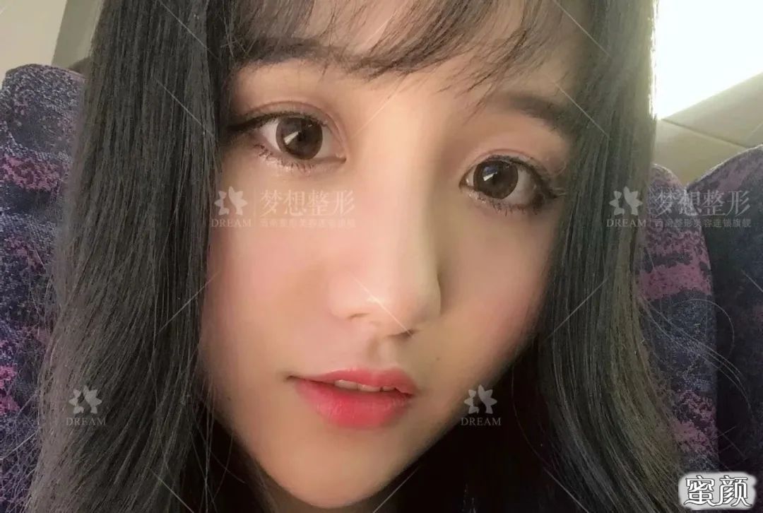 案例图片
