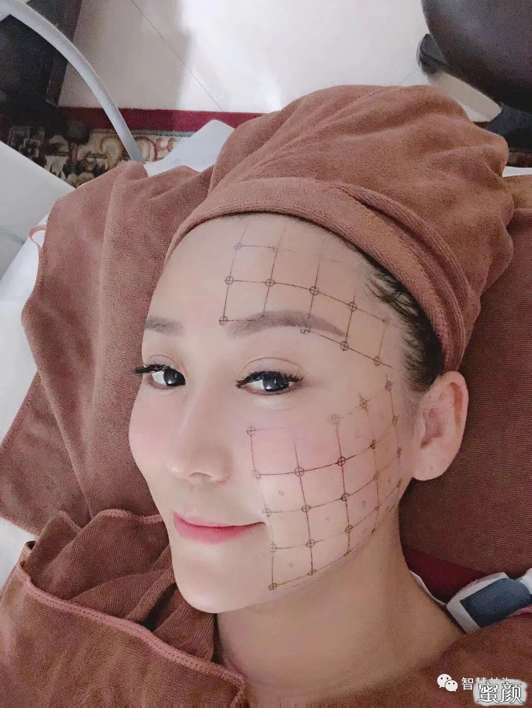 案例图片