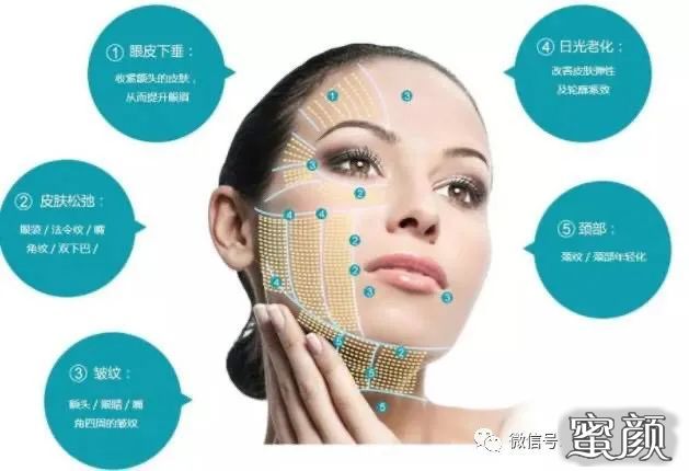 案例图片