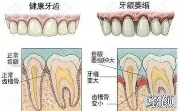 案例图片