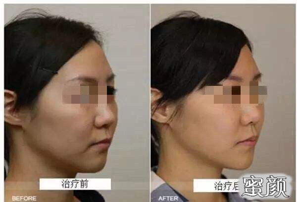 案例图片