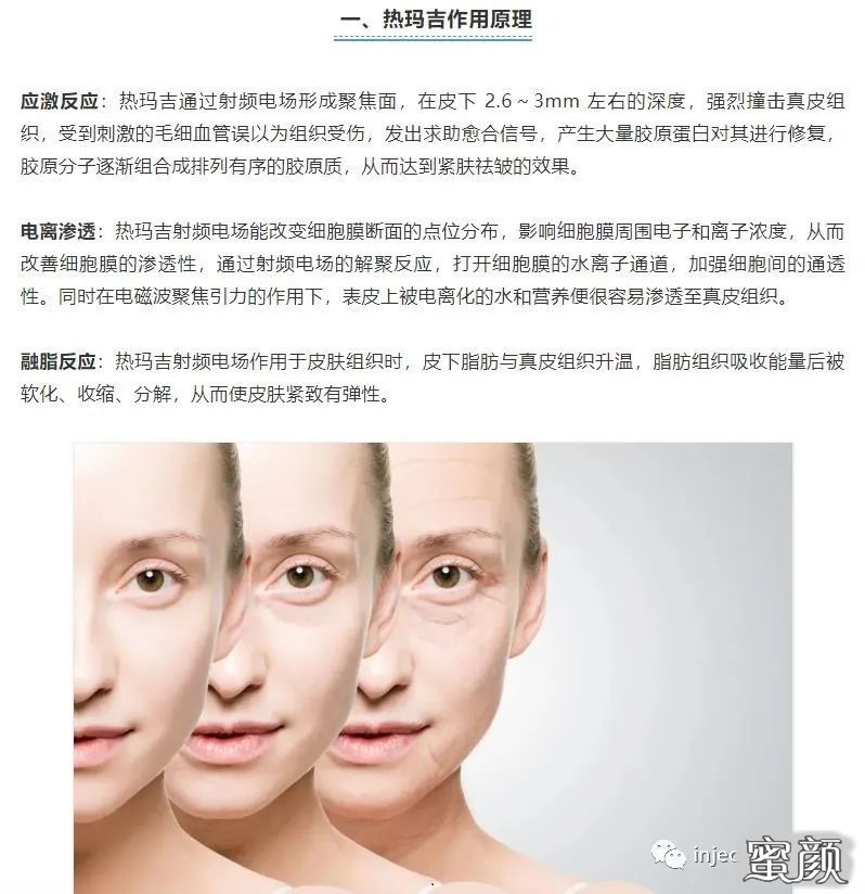 https://img.yiyiaimei.com/mnt/timg/200823/1426435019-1.jpg