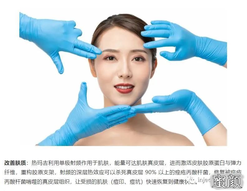 https://img.yiyiaimei.com/mnt/timg/200823/1426494Y9-4.jpg