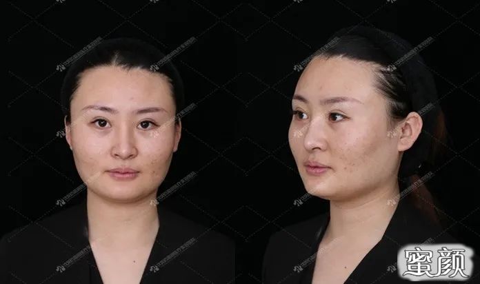 https://img.yiyiaimei.com/mnt/timg/200824/13594R5B-2.jpg