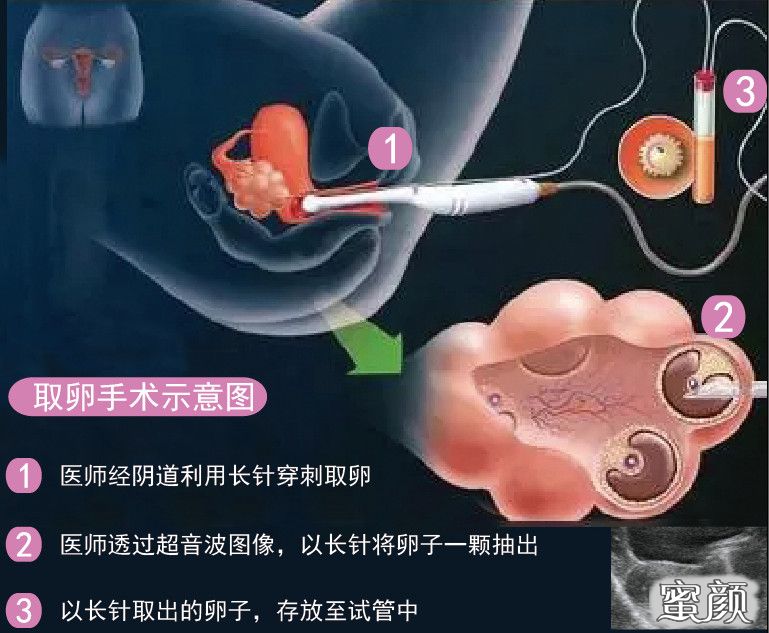 案例图片